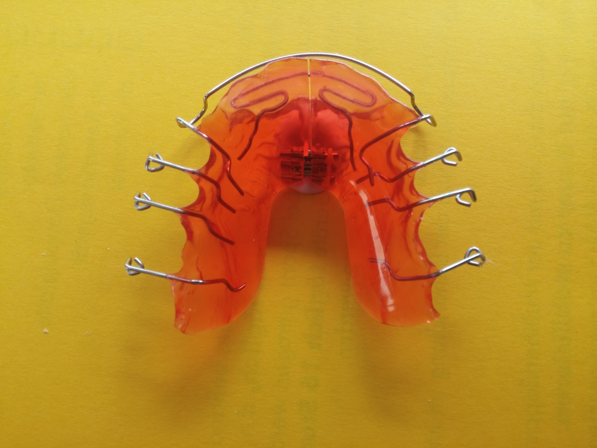 Singura solutie pentru dinti perfect aliniati: aparat dentar ieftin