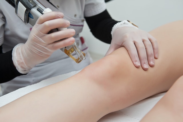 epilare cu IPL