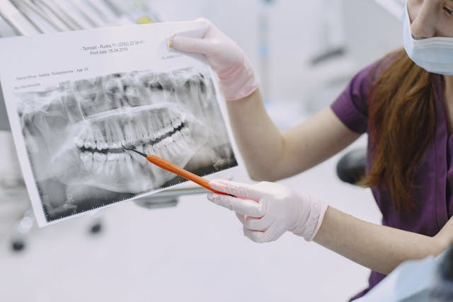 Radiografia panoramică, esențială înainte și după un implant dentar